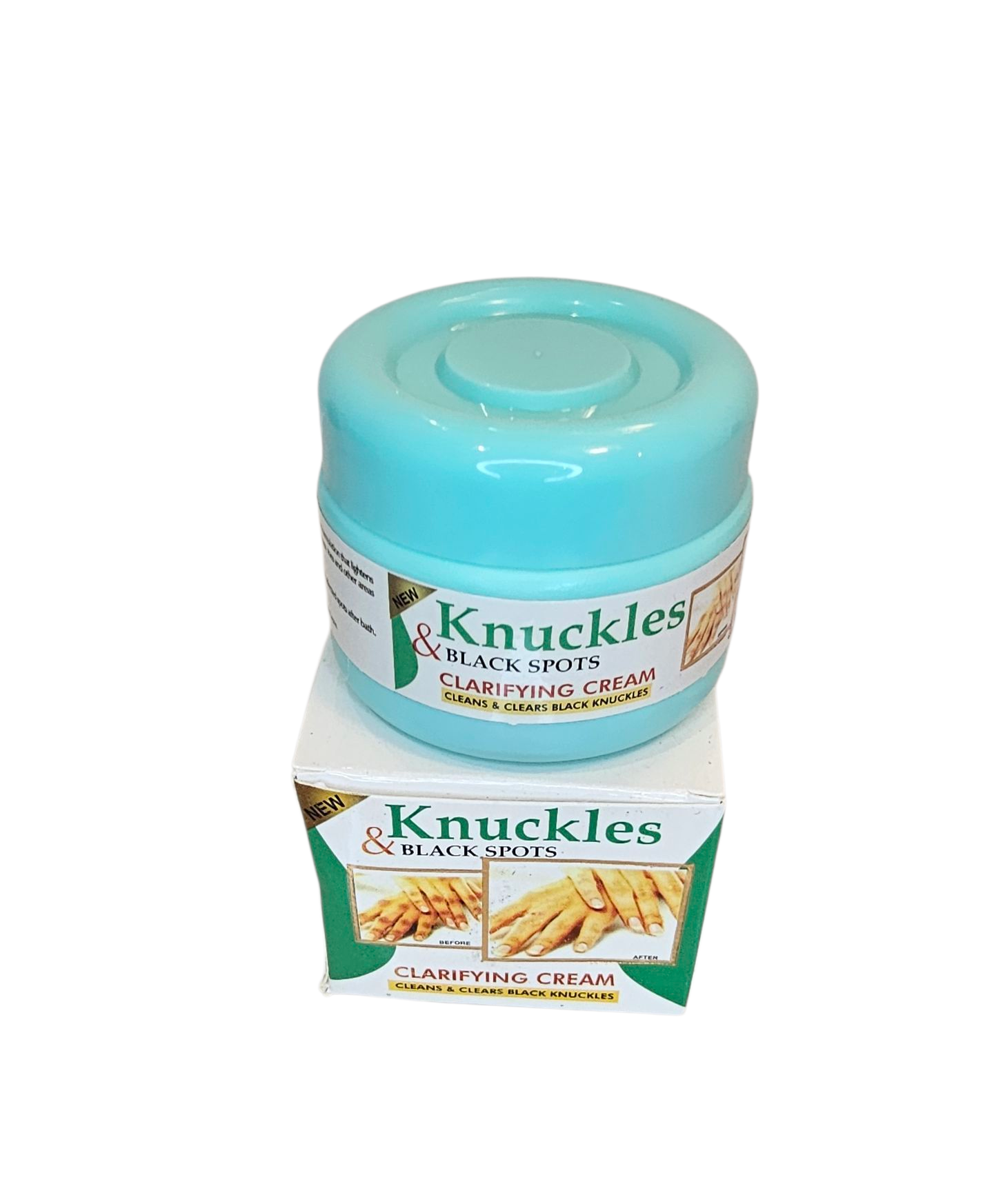 Knuckles & Black Spots Clarifying Cream - 150g - Clears Dark Knuckles and Spots